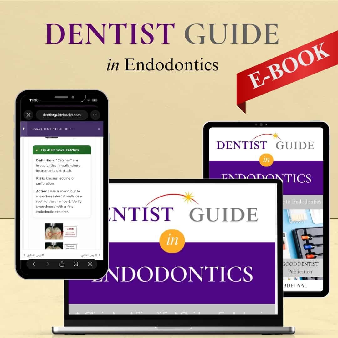 Dentist Guide in ENDODONTICS - E-BOOK